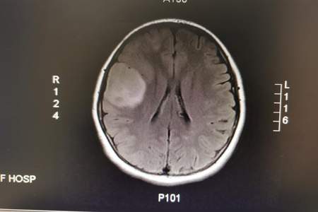 切脑子是什么意思