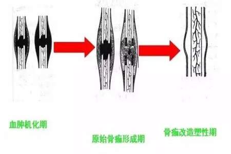 伤筋动骨下一句谚语是什么